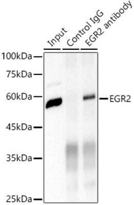 Immunoprecipitation: EGR2 Antibody (1F6V7) [NBP3-16157]