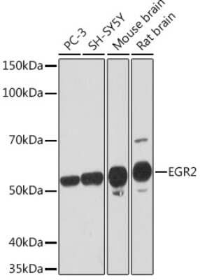 Western Blot: EGR2 Antibody (1F6V7) [NBP3-16157]