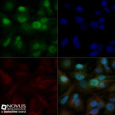 Immunocytochemistry/ Immunofluorescence: EGR2 Antibody - BSA Free [NB100-92327]