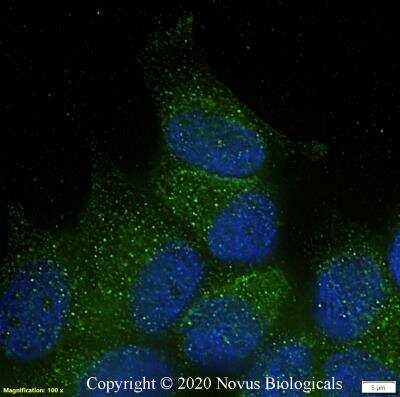 Immunocytochemistry/ Immunofluorescence: EGR2 Antibody - BSA Free [NB110-59723]