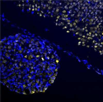 Immunocytochemistry/ Immunofluorescence: EGR2 Antibody - BSA Free [NB110-59723]