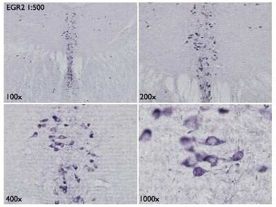 Immunohistochemistry-Frozen: EGR2 Antibody [NBP2-16286]