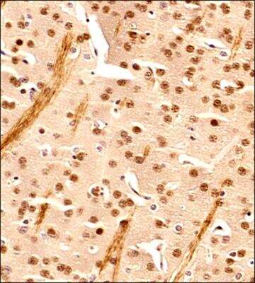 Immunohistochemistry-Paraffin: EGR2 Antibody - BSA Free [NB100-92327]
