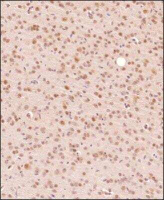 Immunohistochemistry-Paraffin: EGR2 Antibody - BSA Free [NB110-59723]