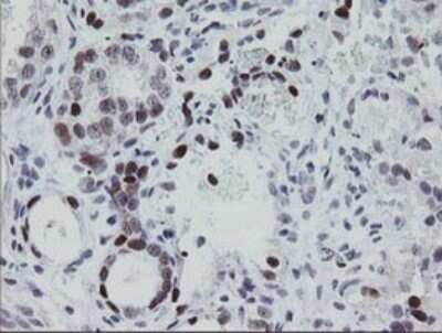 Immunohistochemistry: EGR2 Antibody (OTI1B12) - Azide and BSA Free [NBP2-70624]