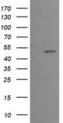 Western Blot: EGR2 Antibody (OTI1B12)Azide and BSA Free [NBP2-70624]