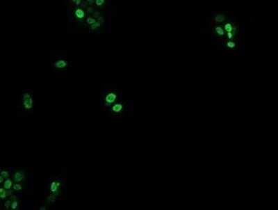 Immunocytochemistry/ Immunofluorescence: EGR2 Antibody (OTI1B12) [NBP2-45696]