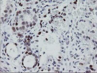Immunohistochemistry: EGR2 Antibody (OTI1B12) [NBP2-45696]