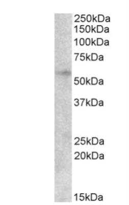 Western Blot: EGR2 Antibody [NB100-68146]