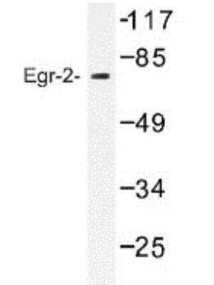Western Blot: EGR2 AntibodyBSA Free [NB100-92327]