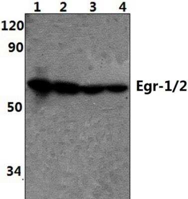 Western Blot: EGR2 AntibodyBSA Free [NB100-92327]