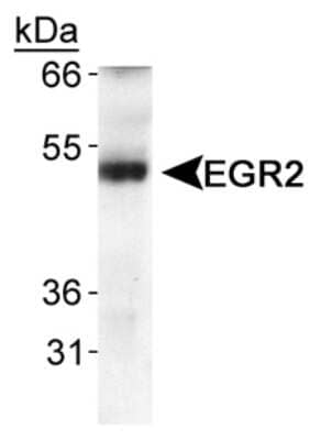 Western Blot: EGR2 AntibodyBSA Free [NB110-59723]