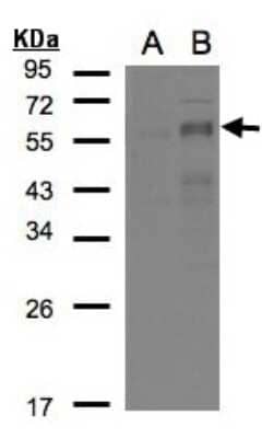 Western Blot: EGR2 Antibody [NBP2-16286]