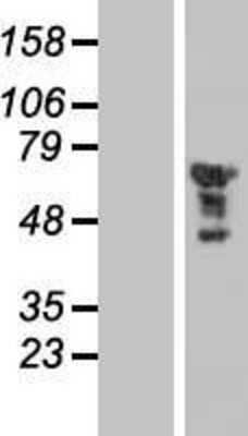 Western Blot: EGR2 Overexpression Lysate [NBP2-09030]