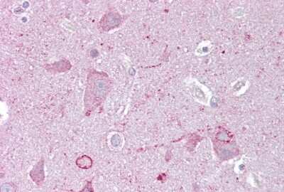 Immunohistochemistry: EGR3 Antibody [NBP2-82977]