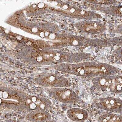 Immunohistochemistry-Paraffin: EGR3 Antibody [NBP1-80903]