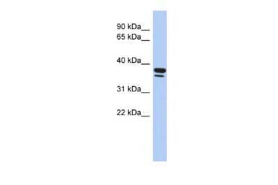 Western Blot: EGR3 Antibody [NBP2-82978]