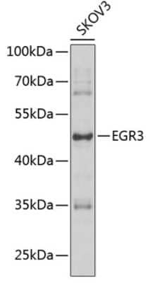 Western Blot: EGR3 AntibodyBSA Free [NBP2-92512]