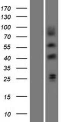 Western Blot: EGR3 Overexpression Lysate [NBP2-07872]