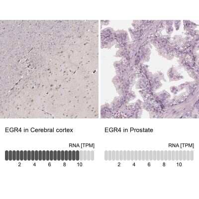 Immunohistochemistry-Paraffin: EGR4 Antibody [NBP1-80999]