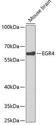 Immunohistochemistry-Paraffin: EGR4 Antibody - Azide and BSA Free [NBP2-92774]