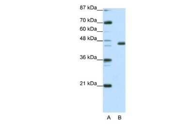 Western Blot: EGR4 Antibody [NBP2-84842]