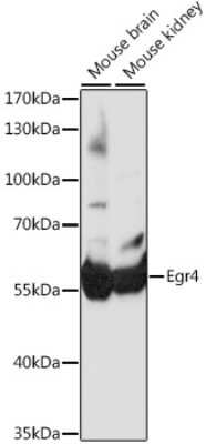 Western Blot: EGR4 AntibodyAzide and BSA Free [NBP2-92760]