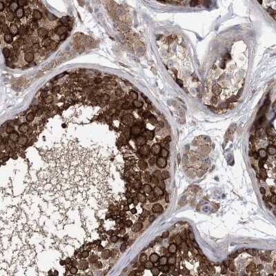 Immunohistochemistry-Paraffin: EHBP1 Antibody [NBP1-93614]