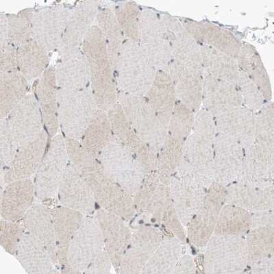 Immunohistochemistry-Paraffin: EHBP1 Antibody [NBP1-93614]