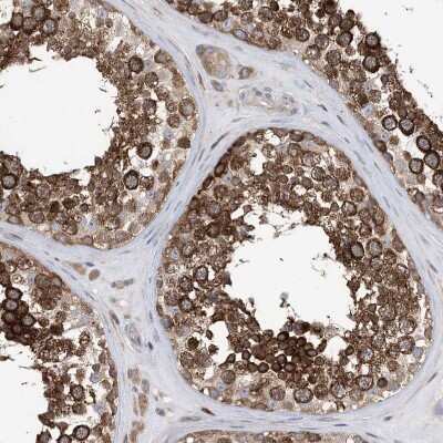 Immunohistochemistry-Paraffin: EHBP1 Antibody [NBP1-93614]