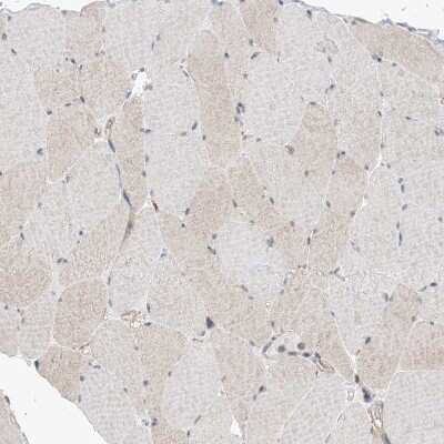 Immunohistochemistry-Paraffin: EHBP1 Antibody [NBP1-93614]