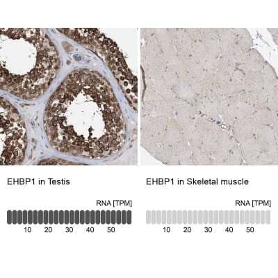 Immunohistochemistry-Paraffin: EHBP1 Antibody [NBP1-93615]