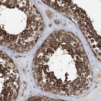 Immunohistochemistry-Paraffin: EHBP1 Antibody [NBP1-93615]