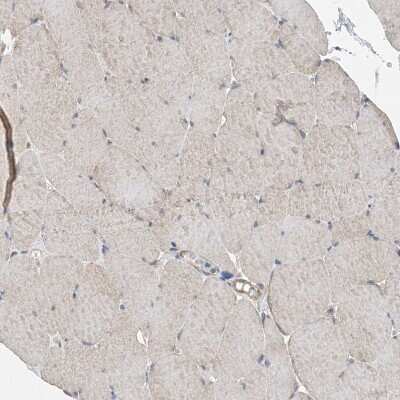 Immunohistochemistry-Paraffin: EHBP1 Antibody [NBP1-93615]