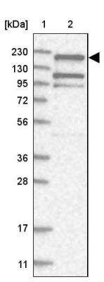 Western Blot: EHBP1 Antibody [NBP1-93614]