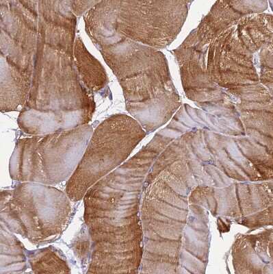 Immunohistochemistry-Paraffin: EHBP1L1 Antibody [NBP1-90496]
