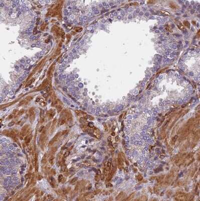 Immunohistochemistry-Paraffin: EHBP1L1 Antibody [NBP1-90496]