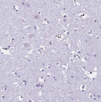 Immunohistochemistry-Paraffin: EHBP1L1 Antibody [NBP1-90496]