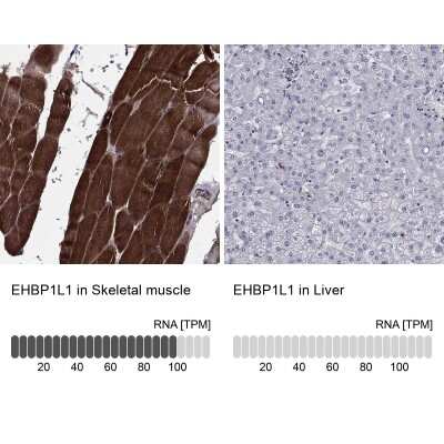 Immunohistochemistry-Paraffin: EHBP1L1 Antibody [NBP3-17136]