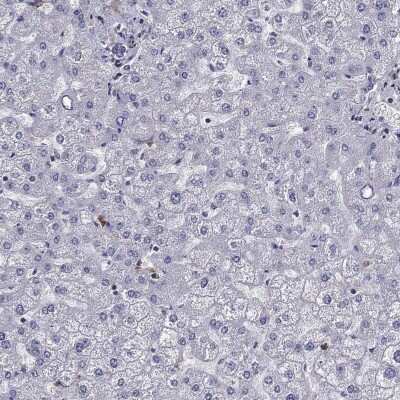 Immunohistochemistry-Paraffin: EHBP1L1 Antibody [NBP3-17136]