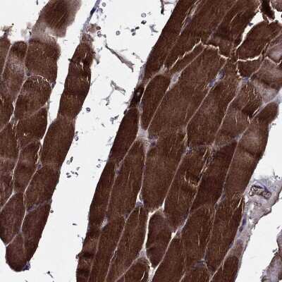 Immunohistochemistry-Paraffin: EHBP1L1 Antibody [NBP3-17136]