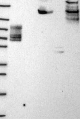 Western Blot: EHBP1L1 Antibody [NBP3-17136]