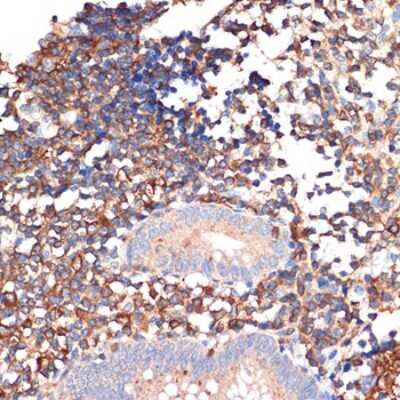 Immunohistochemistry-Paraffin: EHD1 Antibody (5S4P9) [NBP3-16201]