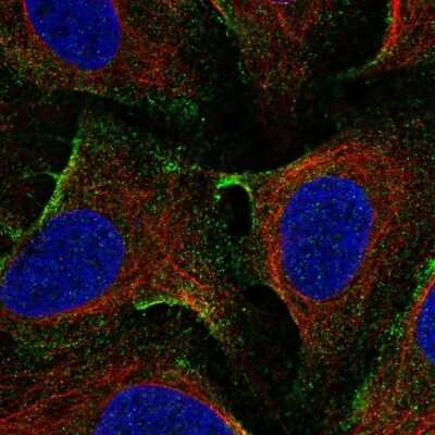 Immunocytochemistry/ Immunofluorescence: EHD1 Antibody [NBP2-56035]