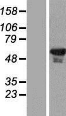 Western Blot: EHD1 Overexpression Lysate [NBP2-07580]