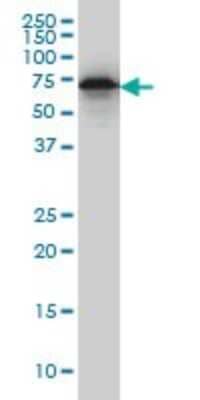 Western Blot: EHD2 Antibody (2D8) [H00030846-M01]