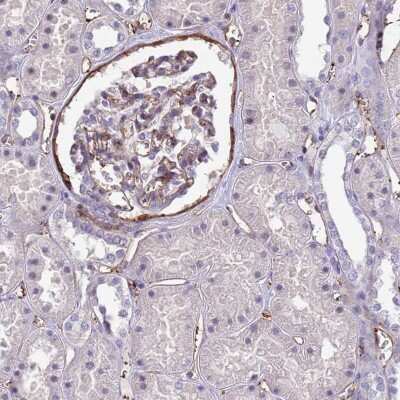 Immunohistochemistry-Paraffin: EHD2 Antibody [NBP2-33283]