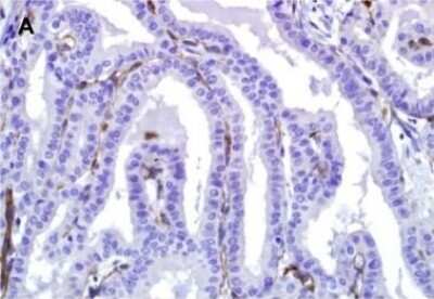Immunohistochemistry: EHD2 Antibody [NBP2-33283]