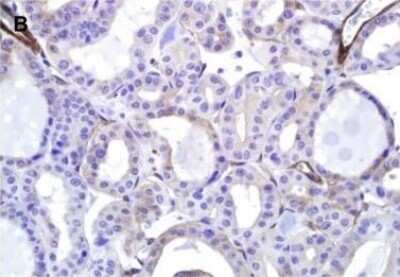 Immunohistochemistry: EHD2 Antibody [NBP2-33283]