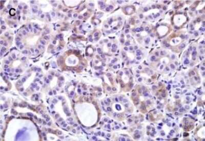 Immunohistochemistry: EHD2 Antibody [NBP2-33283]